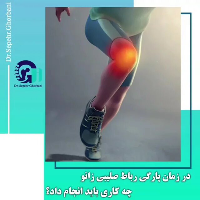 اولین اقدام هنگام پارگی رباط صلیبی زانو