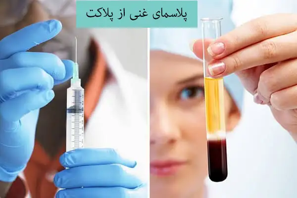 تزریق پی ار پی