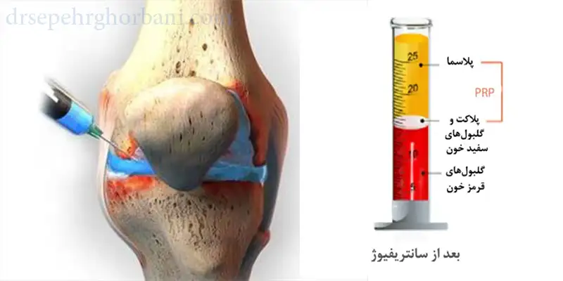 ساختار پلاسما