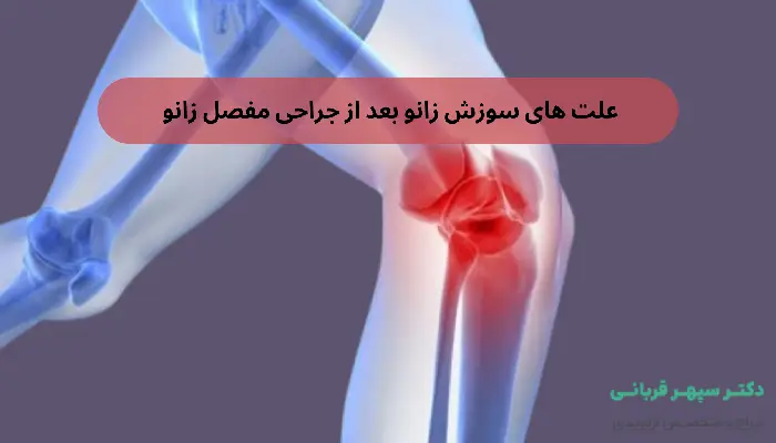 علت های سوزش زانو بعد از جراحی مفصل زانو
