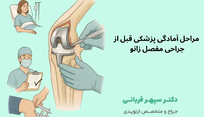مراحل آمادگی پزشکی قبل از جراحی مفصل زانو