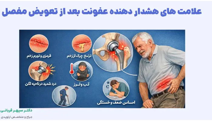 علامت های هشدار دهنده عفونت بعد از تعویض مفصل لگن