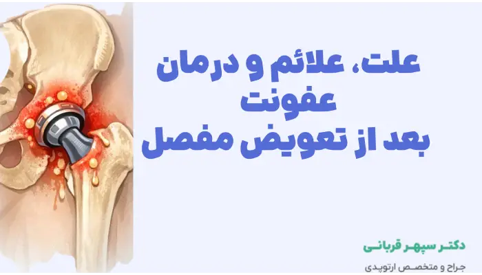علت، علائم و درمان عفونت
بعد از تعویض مفصل