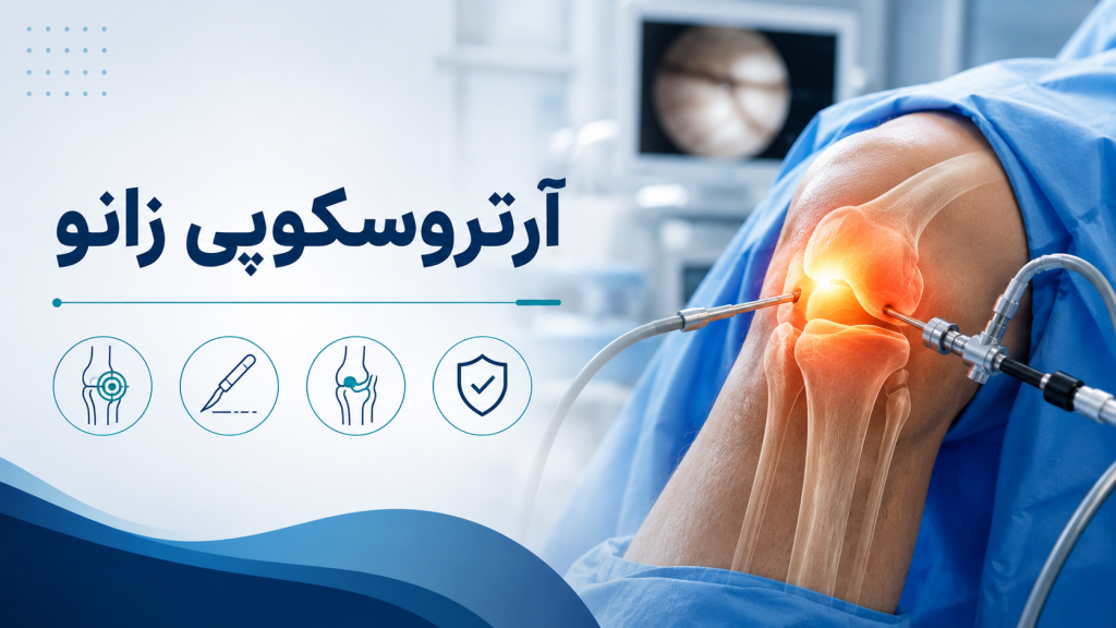 آرتروسکوپی زانو در زنجان