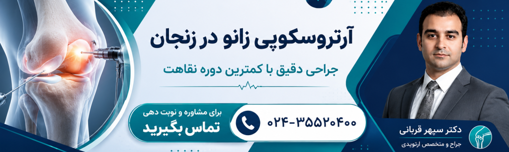 مشاوره مشاوره ارتروسکوپی زانو در زنجان